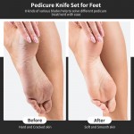 Pedicure Knife Kit, 8pcs Black Foot Dead Callus Remover Stainless Set, Professional Ingrown Toenail Steel Tools, Feet Skin Care Nail File Tool Manicure Clippers Cuticle Scraper Toe Shaver Pedicure Knife Kit, 8pcs Black Foot Dead Callus Remover Stainless Set, Professional Ingrown Toenail Steel Tools, Feet Skin Care Nail File Tool Manicure Clippers Cuticle Scraper Toe Shaver